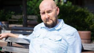 skynews-aaron-james-eye-transplant_6680139-1